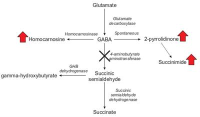 2-Pyrrolidinone and Succinimide as Clinical Screening Biomarkers for GABA-Transaminase Deficiency: Anti-seizure Medications Impact Accurate Diagnosis